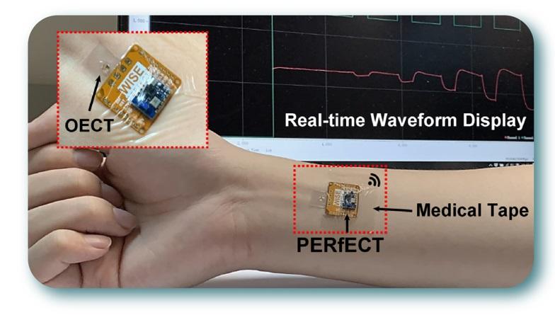 An acronym for Personalised Electronic Reader for Electrochemical Transistors