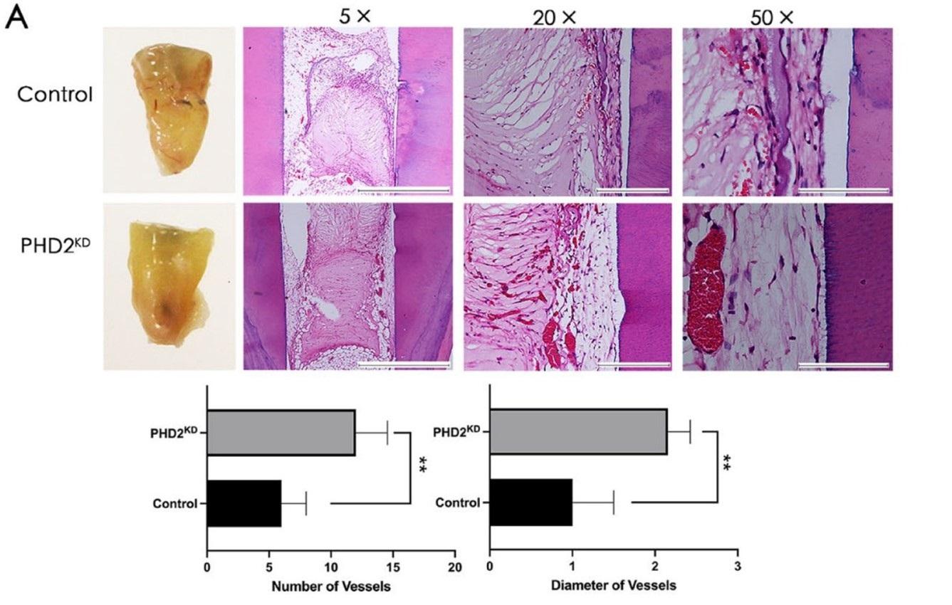 Tooth stem cells modified to mimic a cellular state similar to that under low oxygen (PHD2KD) gave rise to tooth pulp tissue with a significantly increased amount of blood vessels.